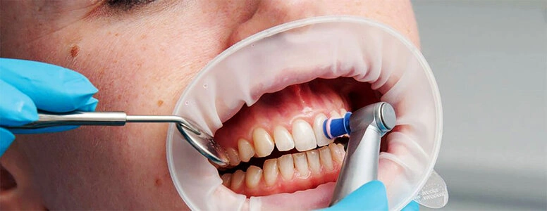 M_height.jpg M_height.jpg